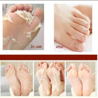 Baby Foot Peeling Mask ( 1 Pair) July 2018 - 2 Baby Foot Peeling Mask ( 1 pair) - 2