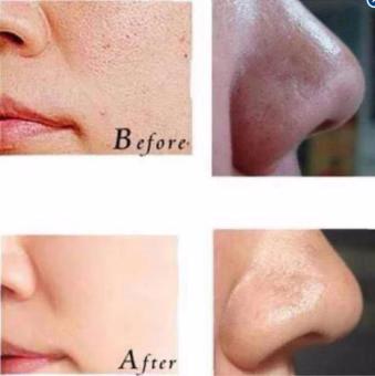 Best Quality Pilaten Black Head Remover 60g June 2018 - 2 Best Quality Pilaten Black Head Remover 60g - 2