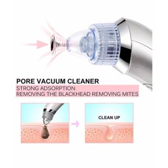 Facial Skin Care Acne Blackhead Remover Vacuum Suction Pore Clean Machine White June 2018 - 5 Facial Skin Care Acne Blackhead Remover Vacuum Suction Pore Clean Machine White - 5