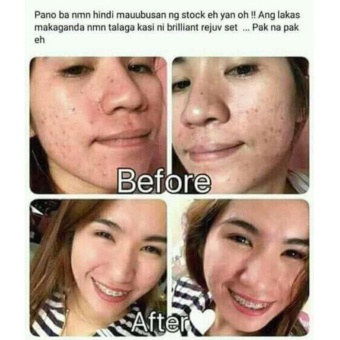 REJUVENATING FACIAL SET BY BRILLIANT SKIN May 2018 - 2 REJUVENATING FACIAL SET BY BRILLIANT SKIN - 2